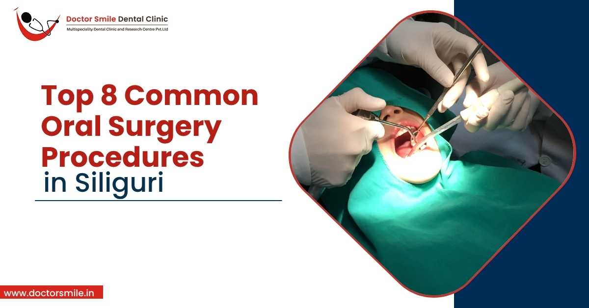 Top 8 Common Oral Surgery Procedures