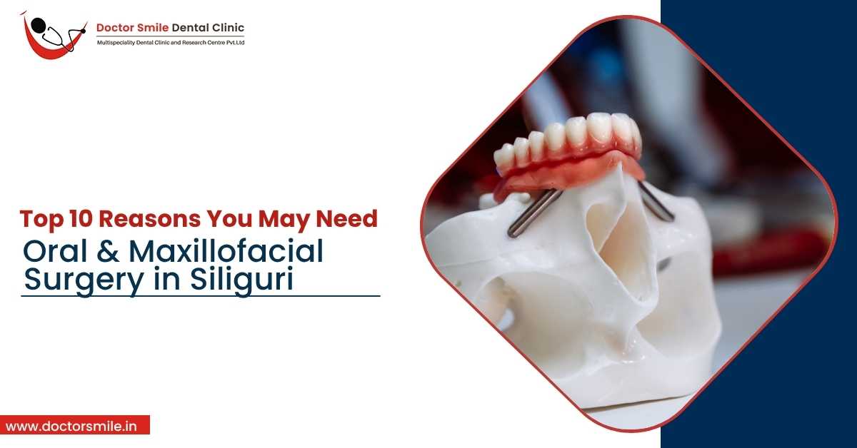 Top 10 Reasons You May Need Oral and Maxillofacial Surgery in Siliguri