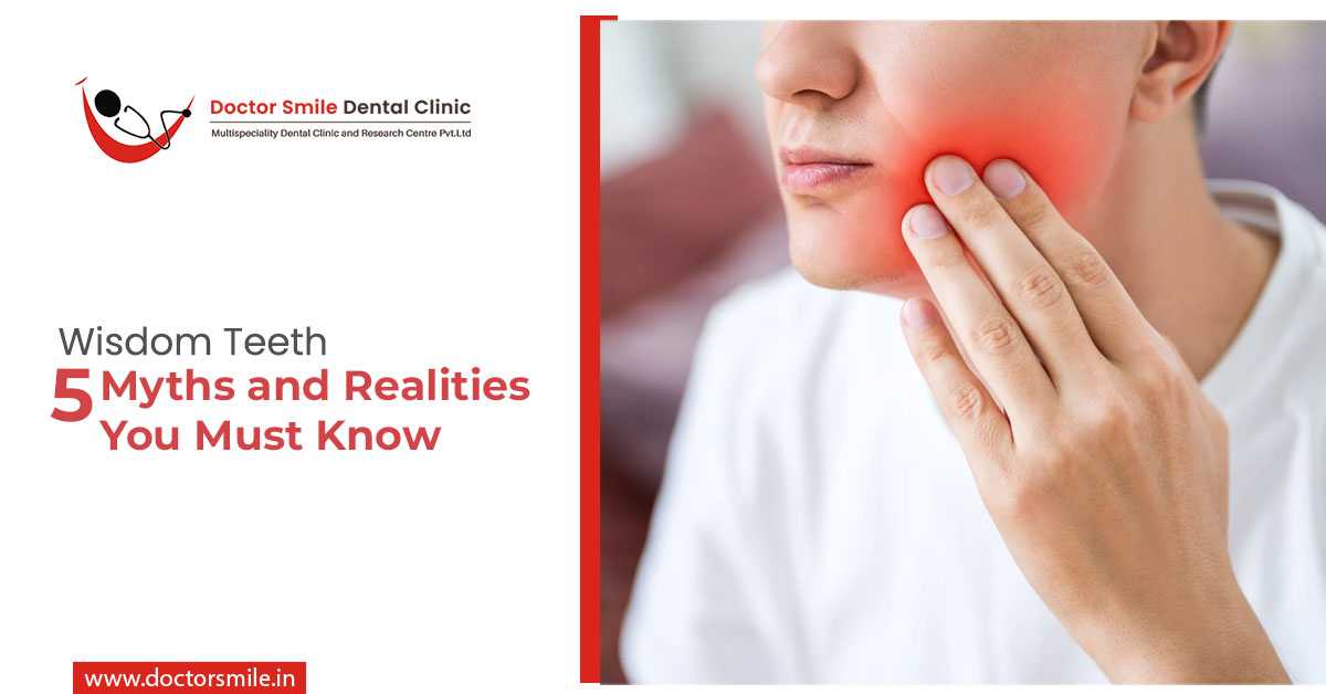 Wisdom Teeth: 5 Myths and Realities