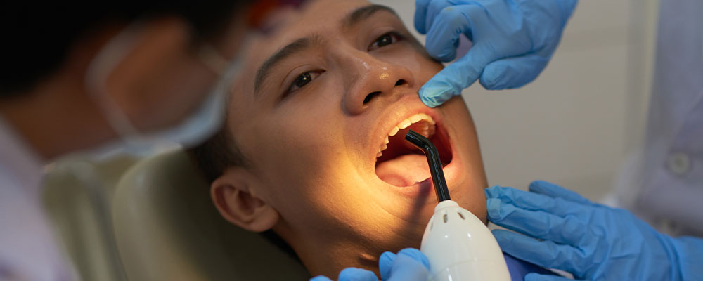 Painless Root Canal Treatment